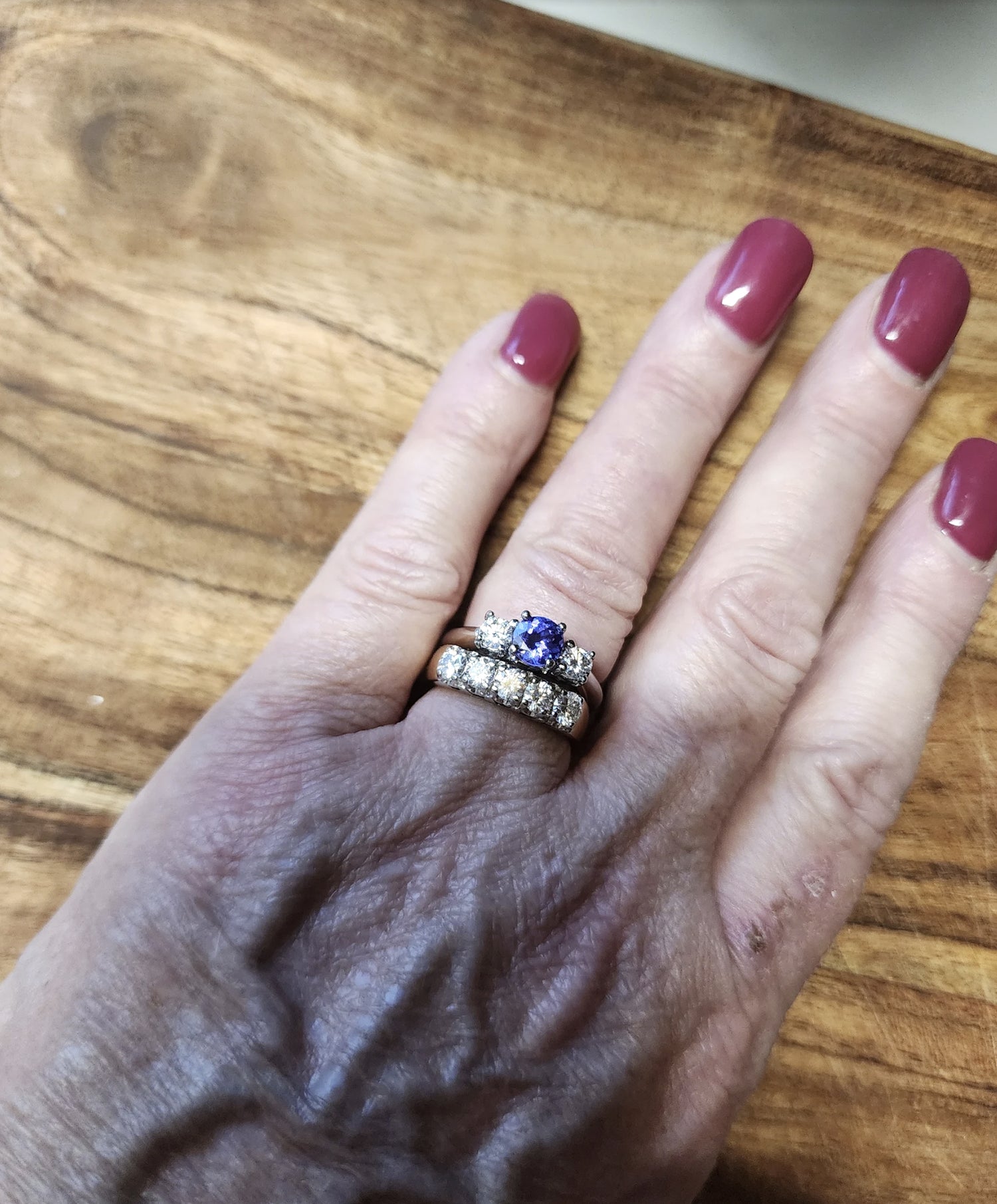 Repaired rings back on customer's hand - fully repaired